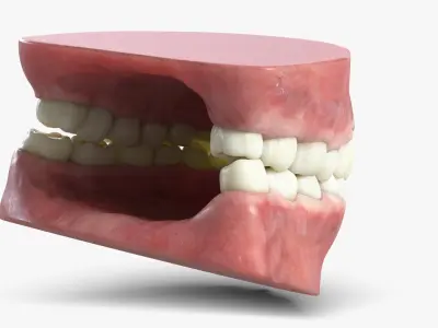  Human Teeth and Gum 