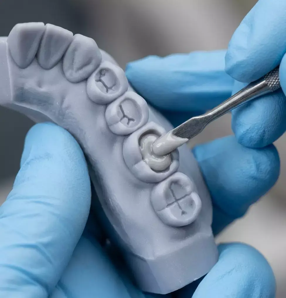 Occlusal Restoration Training Models  Upper and Lower 3D print model