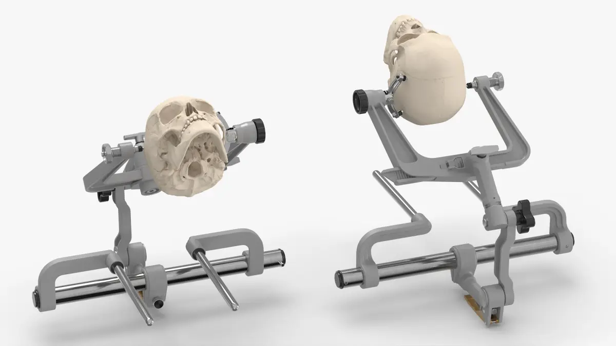 Neurosurgical Cranial Fixation Device with Skull 3D model