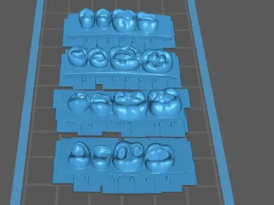 Dental training models 3D print model