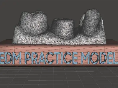 EDM Dental Practice Standard Model Class 2 and Bridge 3D print model