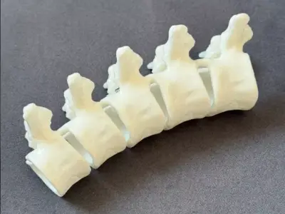 Spine hair clips v1 3D print model
