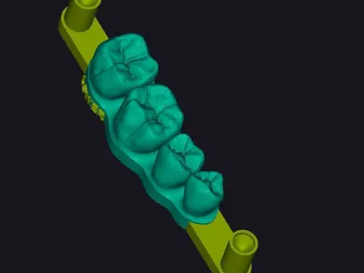 Dental training model Dental Sample model 3D print model 3D print model