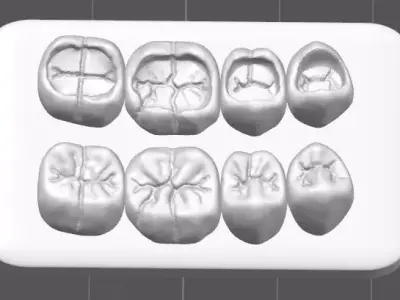 Occlusal Restoration Training Models  Upper and Lower 3D print model purchase