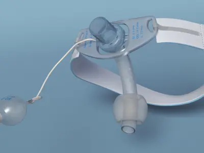  Tracheostomy Tube with Neckband Installed on Patient 