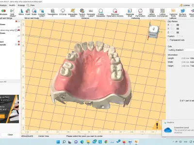 Demo model for exocad   3shape   3d print  3D print model