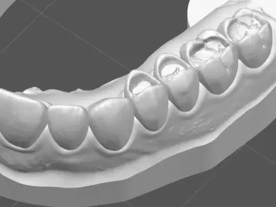 Occlusal Restoration Training Models  Upper and Lower 3D print model