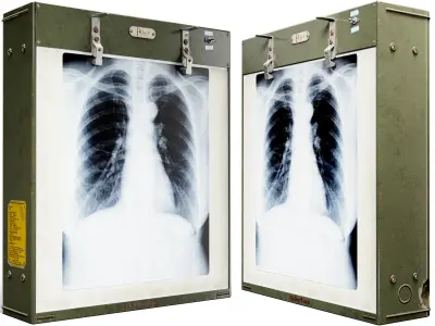 Vintage Radiography Lightbox By Picker Low-poly 3D model