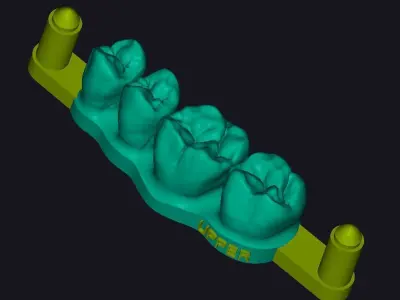 Dental training model Dental Sample model 3D print model 3D print model
