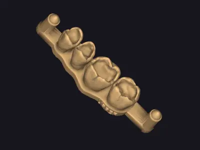Dental training model Dental Sample model 3D print model 3D print model
