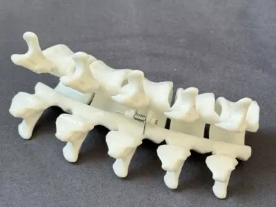 Spine hair clips v1 3D print model