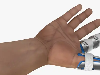  Injured Hand Wearing Orthopedic Finger Splints 