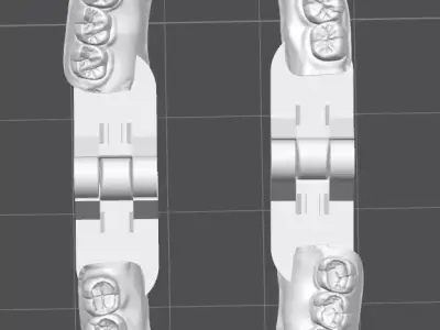 Occlusal Restoration Training Models  Upper and Lower 3D print model