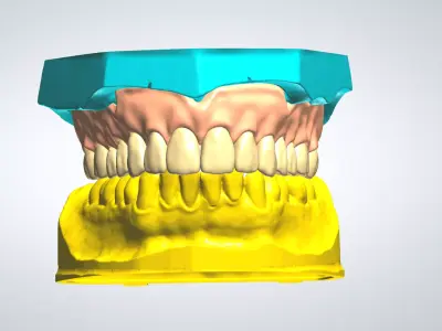 MODELS FULL DENTURE UPPER 3D print model