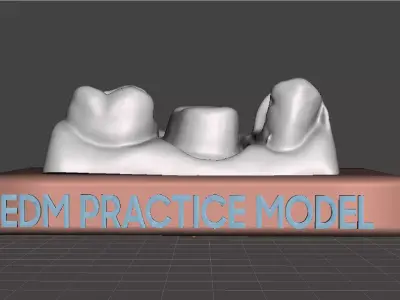 EDM Dental Practice Standard Model Class 2 and Bridge 3D print model