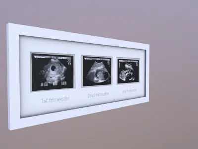 Pregnancy Frame Baby Scan Photo Frame 3D model