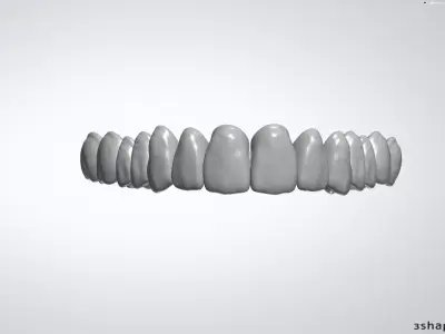MODELS FULL DENTURE UPPER 3D print model