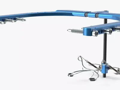 Rigid Distraction Frame for Cranial Surgery Blue 3D model