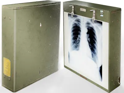 Vintage Radiography Lightbox By Picker Low-poly 3D model