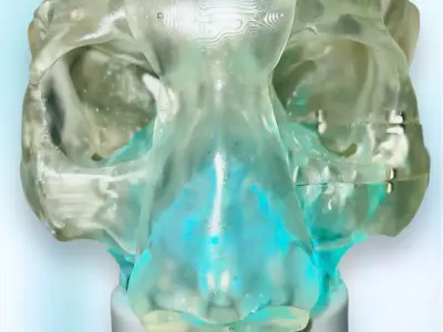 8-part 3D printed Nasal Sinus model from Real CT scan Data 3D print model