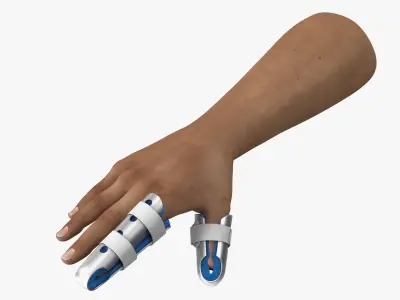  Injured Hand Wearing Orthopedic Finger Splints 