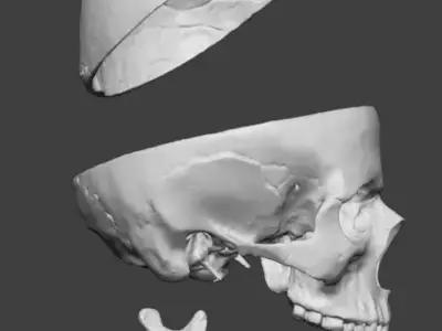 Professional Modular Human Skull - 3-Part Anatomical 3D Scan 3D print model