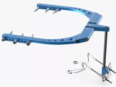 Rigid Distraction Frame for Cranial Surgery Blue 3D model