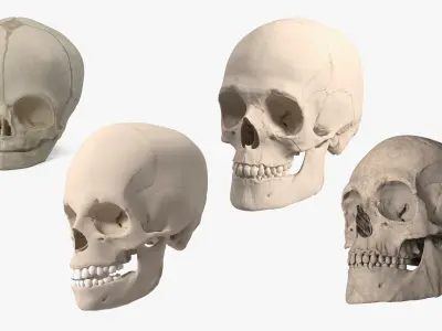 Anatomical Human Skulls Collection 2 3D model