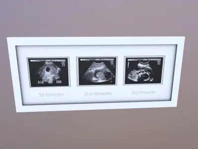 Pregnancy Frame Baby Scan Photo Frame 3D model