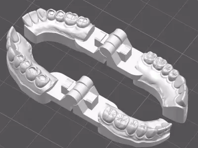 Occlusal Restoration Training Models  Upper and Lower 3D print model