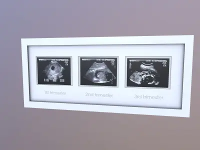 Pregnancy Frame Baby Scan Photo Frame 3D model