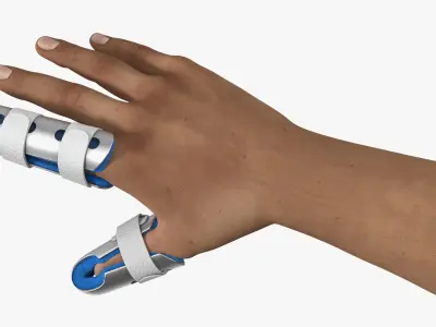  Injured Hand Wearing Orthopedic Finger Splints 