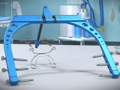 Rigid Distraction Frame for Cranial Surgery Blue 3D model
