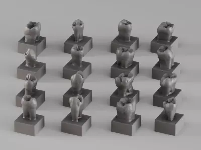 001690 Premium Dental Tooth Collection STL 3D Scan 3D print model