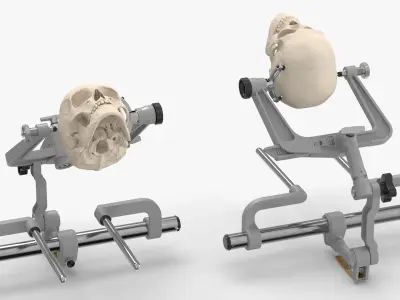 Neurosurgical Cranial Fixation Device with Skull 3D model