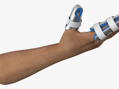  Injured Hand Wearing Orthopedic Finger Splints 