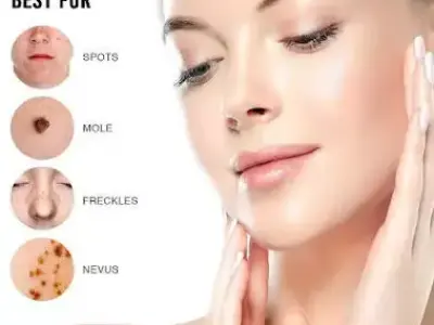 Skin Biotix MD Skin Tag Remover Canada 3D model