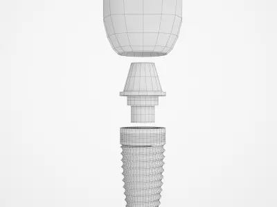 Implant Teeth 02 3D model