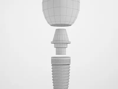 Implant Teeth 02 3D model