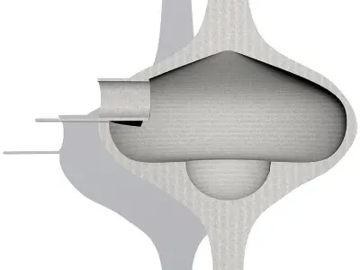 Lovis Community System Free 3D print model