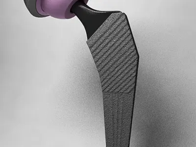 Femoral Prosthesis 3D model